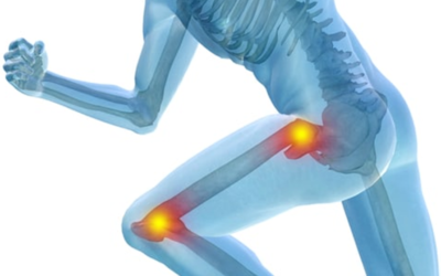 Alleviating Arthritis