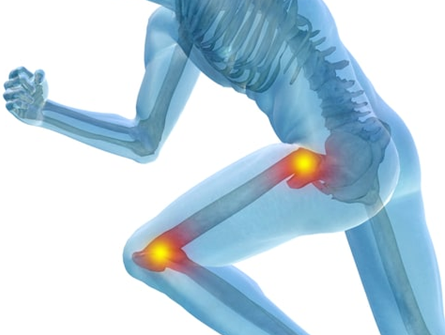 Alleviating Arthritis